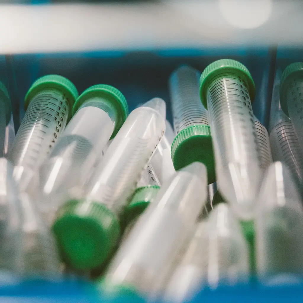 Clear laboratory specimen tubes with green screw caps in a tray.